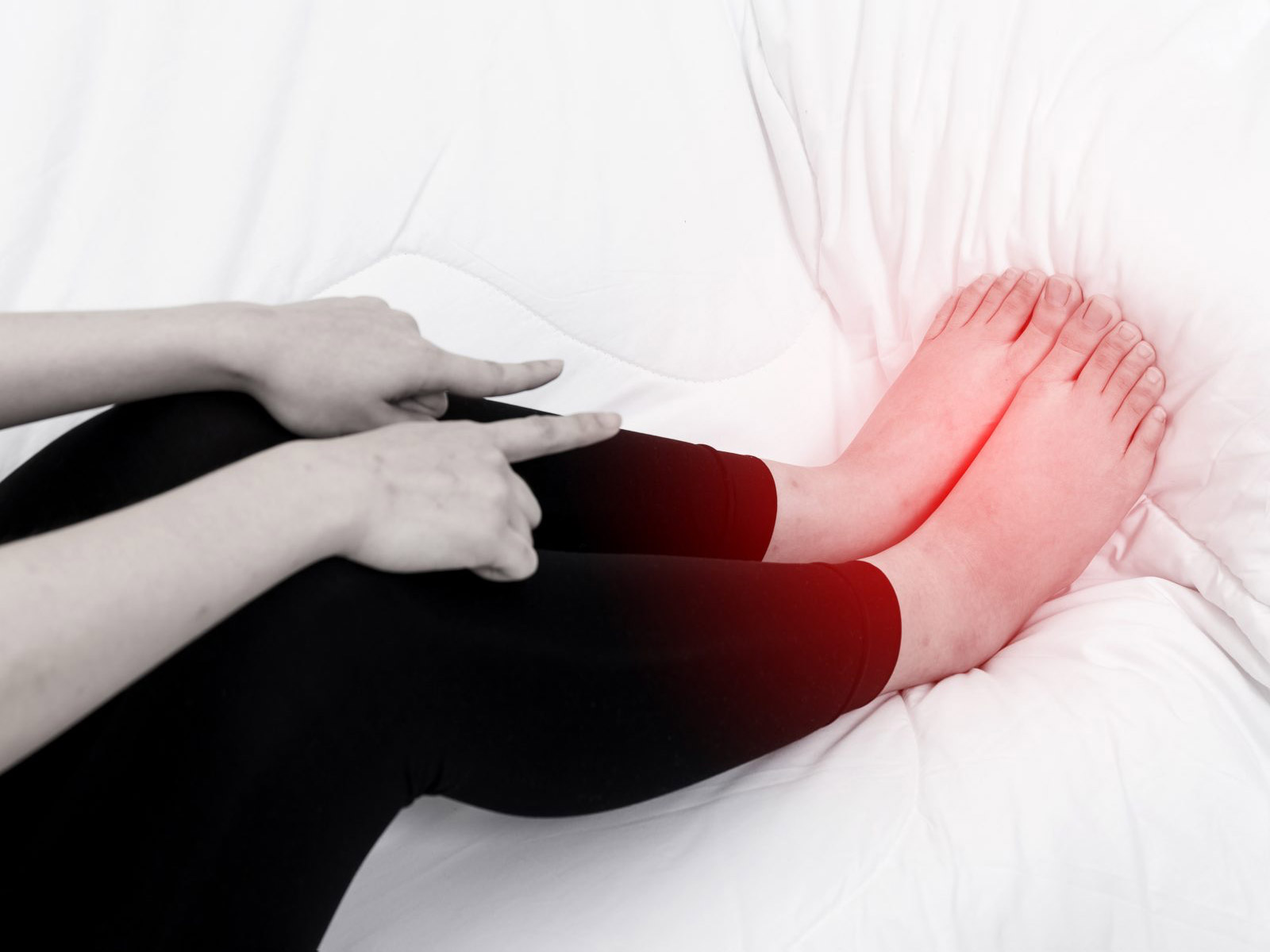 Edema: cuando la inflamación es el síntoma de algo grave