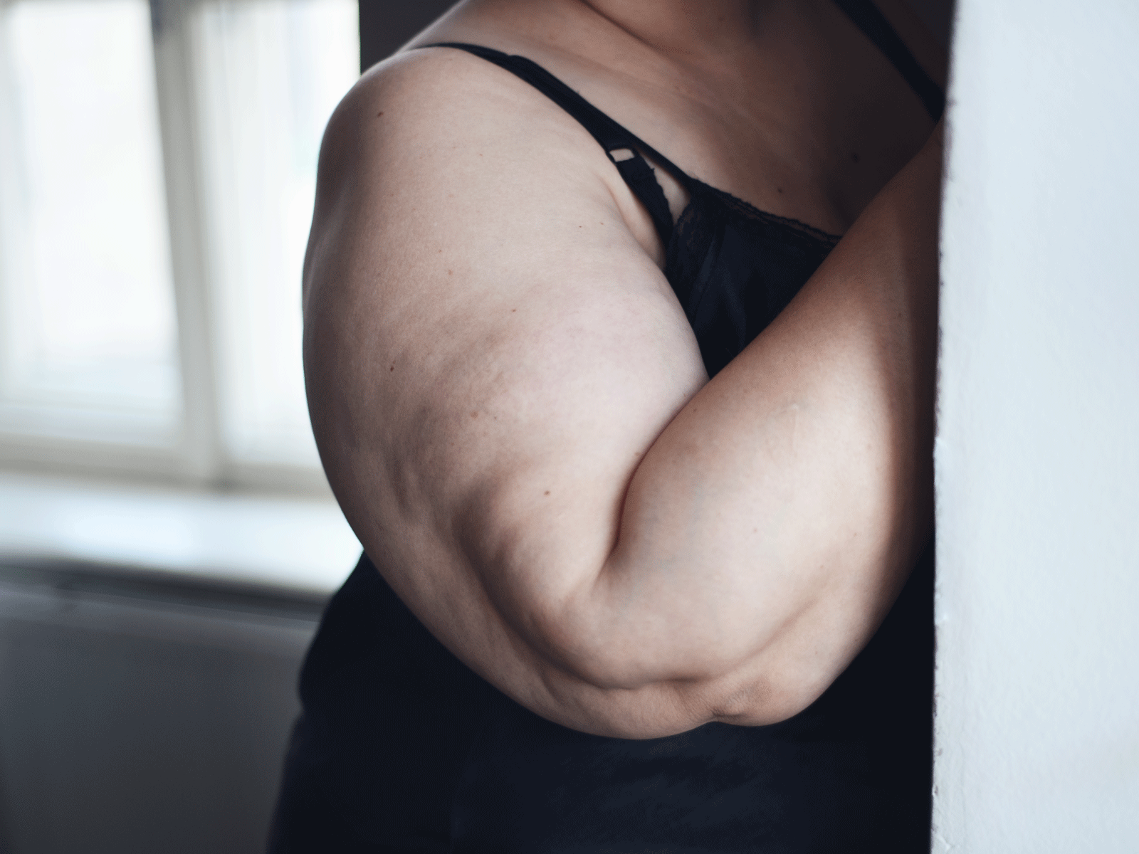 Comment se débarrasser de la cellulite sur les bras : exercices et remèdes